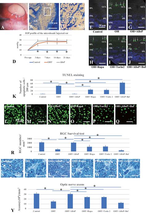 The effects of autophagy activators and autophagy inhibitors on retinal ...