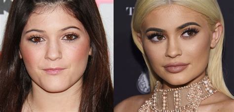 Kylie Jenner Finally Reveals The Truth Behind Her Huge Body ...