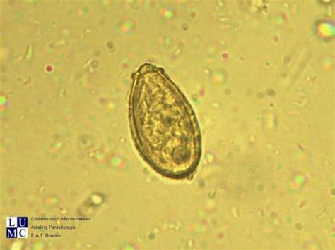 clonorchis_sinensis | Trematodes | Pinterest