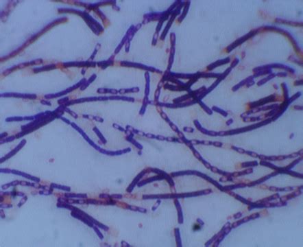 Bacillus anthracis - Microbiology - Medbullets Step 1