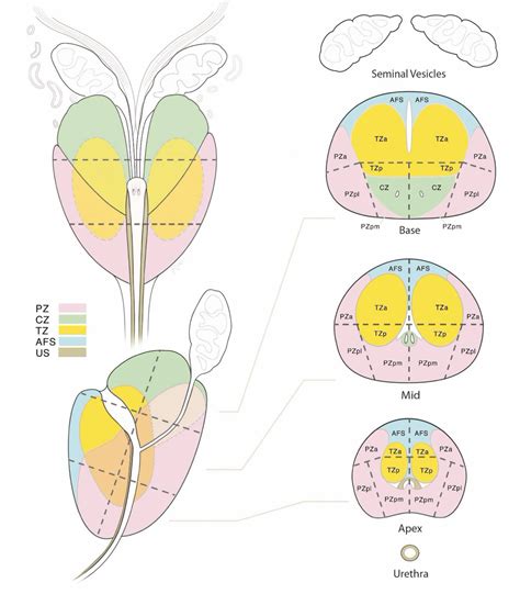 Prostate Gland Anatomy Mri