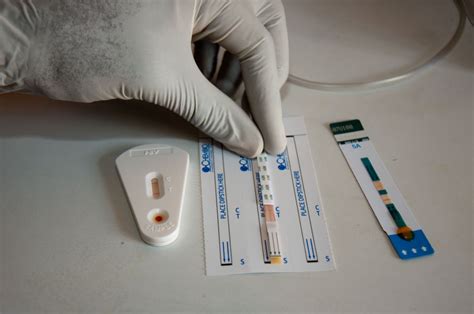 HIV Test Kits – Lisa Marie Albert Documentary Photography