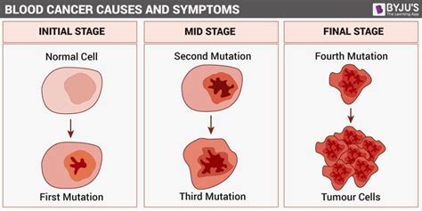 Blood Cancer- Types, Symptoms, Causes and its Treatment