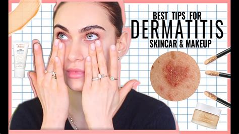 How I Treat My Dermatitis + Makeup for Dermatitis / Eczema | Ruby ...