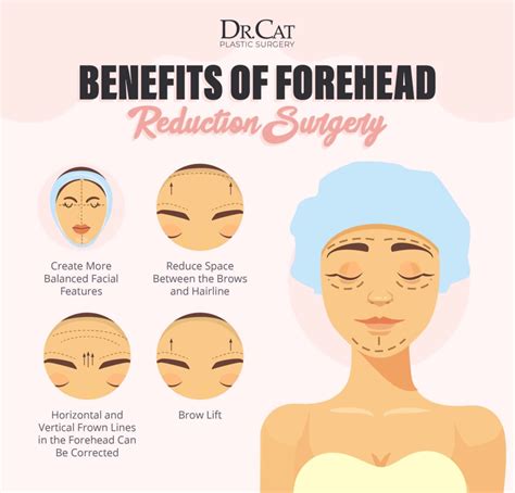 Forehead Reduction Surgery Guide | Lower Hairline Surgery