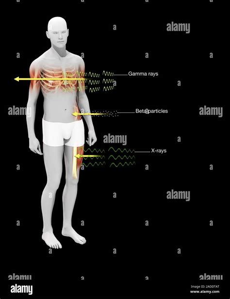 Radiation effects on humans, illustration. Three types of radiation are ...