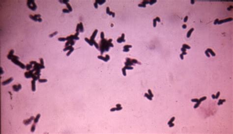 BSCI 424 Pathogenic Microbiology -- Corynebacterium