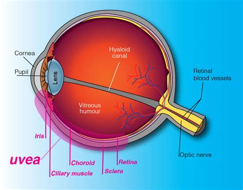 Uveitis | Rand Eye Institute