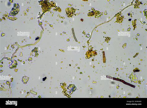 soil sample under the microscope. soil fungi and microorganisms cycling ...