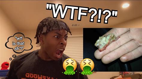 REACTING TO THE LARGEST BOOGER REMOVALS | (DO NOT WATCH ON A FULL ...