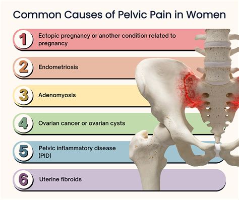 Pelvic Pain Treatment NYC | Pelvic Pain Doctors Specialists in New York