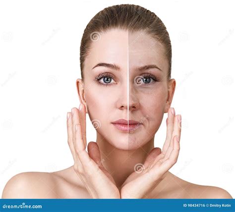 Woman`s Face before and after Rejuvenation. Stock Photo - Image of ...