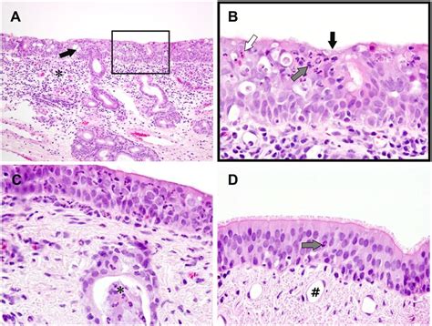 Trachea Histology Goblet Cells