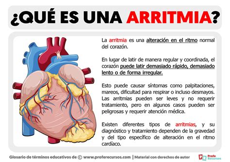 Qué es una Arritmia | Definición de Arritmia