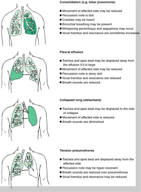 Signs Lung Disease - Physical Exam | EMS Study Material | Pinterest