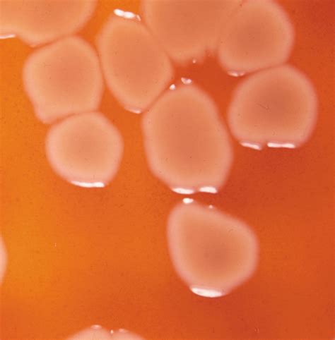 Denitrifying bacteria | Nitrogen Cycle, Soil Microbes, Denitrification ...