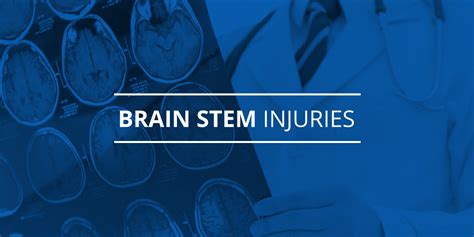 Brain Stem Injuries - Halifax Personal Injury Lawyer Blog