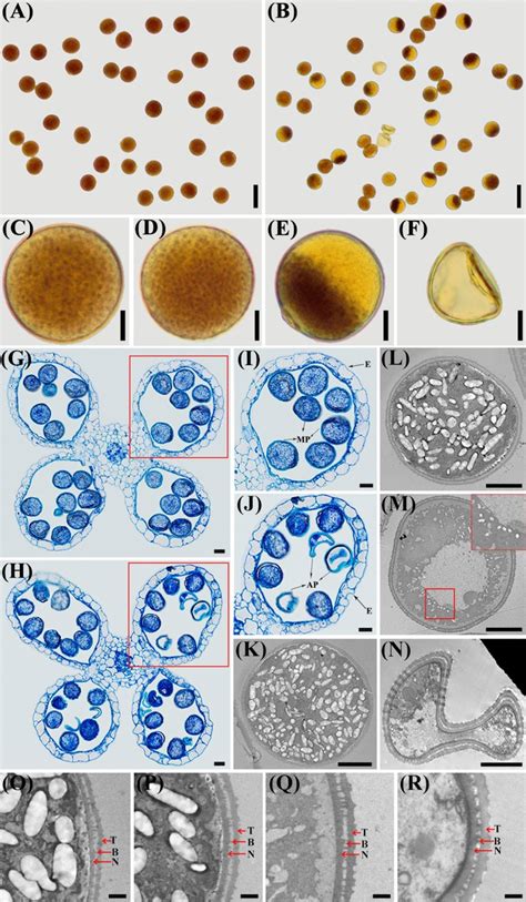 Morphology of pollen grains at the mature pollen stage. a–f Pollen ...