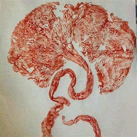 7 best Placenta Art images by Beth MacKenzie Doula on Pinterest | Birth ...