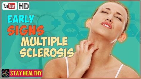 7 Early Signs of Multiple Sclerosis You Should Know About - YouTube