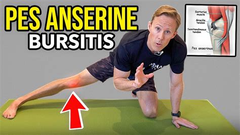 Pes Anserine Bursitis Exercises Google Search Bursitis Knee Knee | The ...