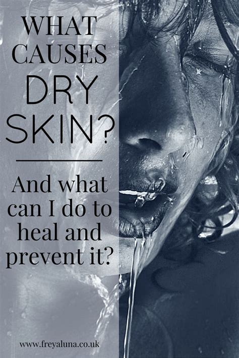 WHAT CAUSES DRY SKIN (and what you can do about it) | Dry skin on face ...