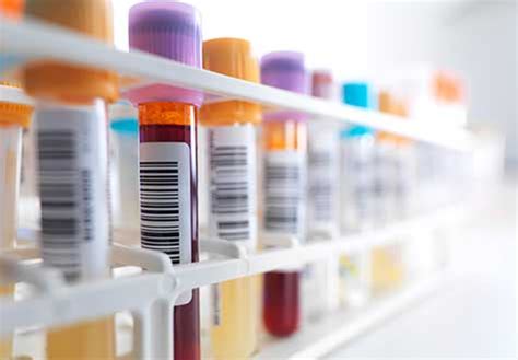 Types of Blood Tests: What Blood Work Can Tell About You