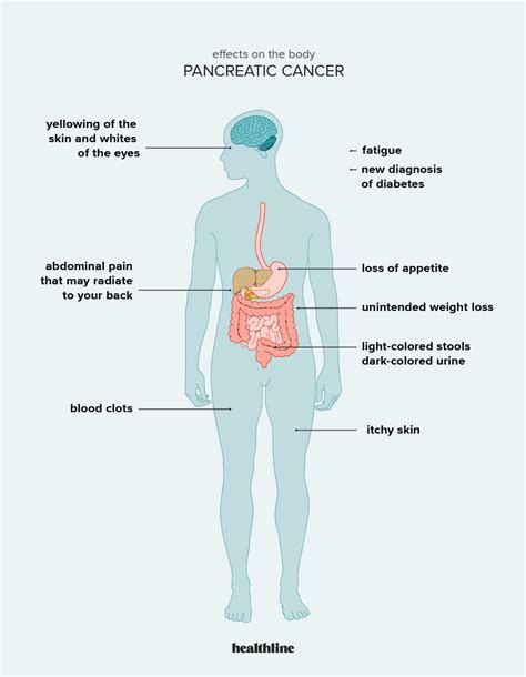 Pancreatic Cancer Symptoms in Men