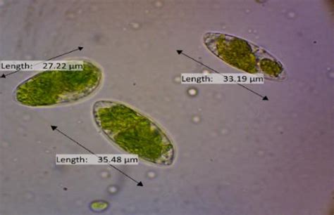 Euglena sp. cells. Under microscope (a) Control Treatment, (b) NaNO3 ...