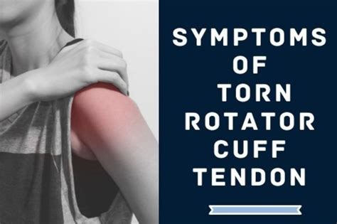 Symptoms of Torn Rotator Cuff Tendon