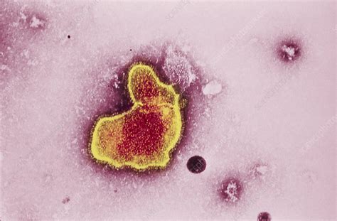 Respiratory syncytial virus - Stock Image - M050/0763 - Science Photo ...