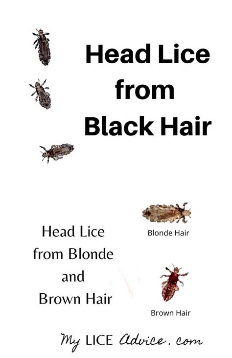 Black Lice and Lice in Black Hair Images | Head louse, Hair lice, Black ...