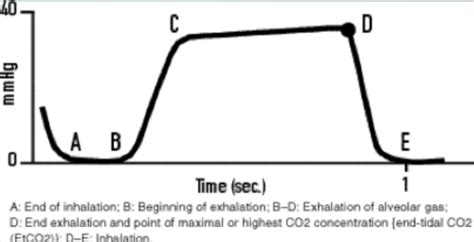 etCO2 Waveforms Flashcards | Quizlet