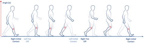 Sensors | Free Full-Text | Gait Analysis in Parkinson’s Disease: An ...