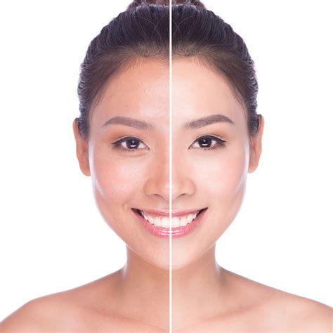 What Is "Skin Brightening," Exactly?