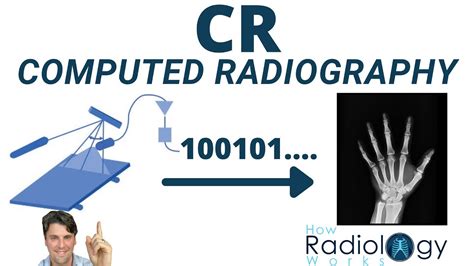 Computed Radiography How it Works (CR Image Receptor) - YouTube