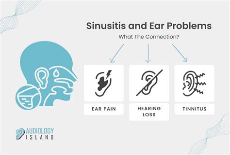 Can Sinusitis Cause Ear Pain and Hearing Loss - Audiology Island