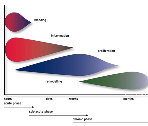 Pulled Muscle Recovery Times — Fixit Physio Belfast