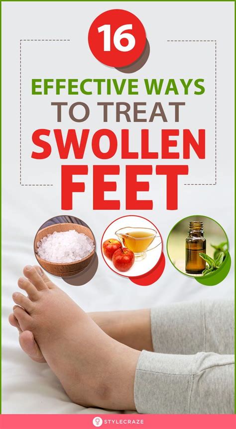 16 home remedies for swollen feet symptoms and treatments – Artofit