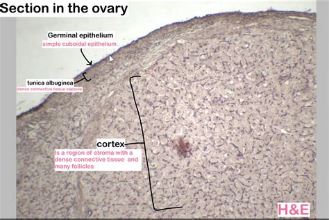 SOLUTION: Histology female reproductive system part 1 - Studypool