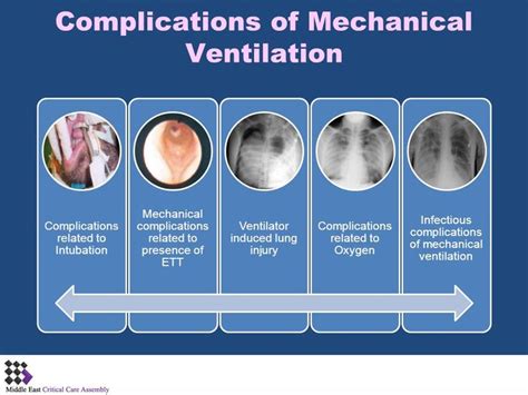 mechanical ventilation | Complications of Mechanical Ventilation - ppt ...