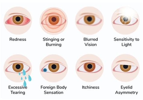 Dry Eye Syndrome – Precision Family Eyecare