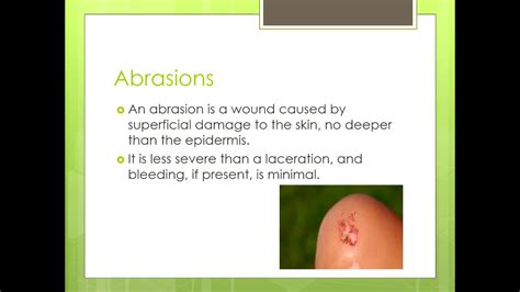 Abrasions, Lacerations, and Contusions Admin - YouTube