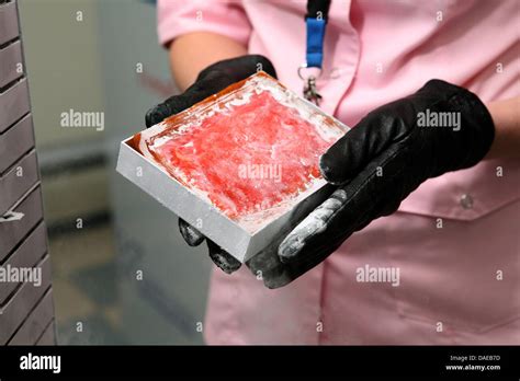 Cord blood stem cells hi-res stock photography and images - Alamy