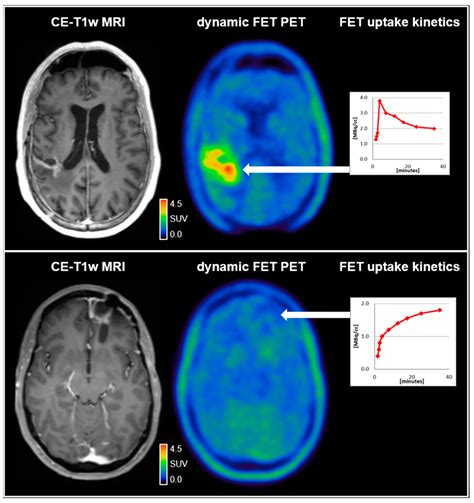 Pet Brain