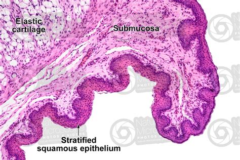 Man. Epiglottis. Longitudinal section. 125X - Man - Mammals ...