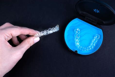 How to Clean Invisalign: Expert Tips for Maintaining Clear Aligners