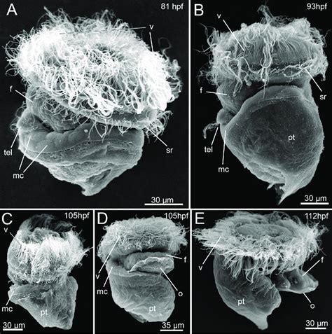 Scanning electron micrograph of the late veliger larvae (81-112 hpf ...