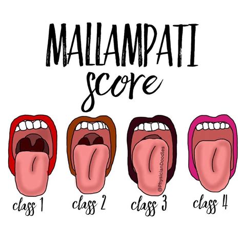 Mallampati Score