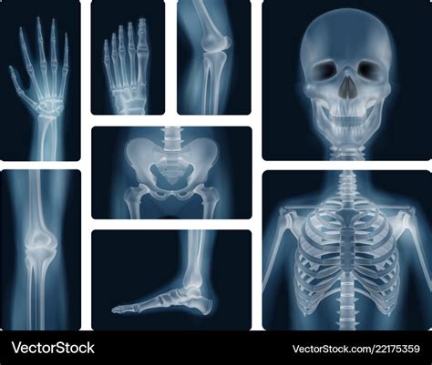 Human Skeleton X Ray